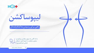 لیپوساکشن: راهی برای رسیدن به اندام ایده‌آل