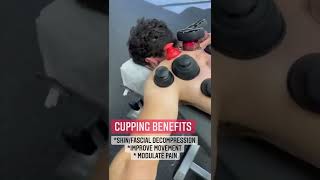 Cupping Benefits. #cuppingtherapy #cupping #backpainrelief