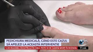 Pedichiură medicală. Când este cazul să apelezi la această intervenţie