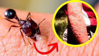 The 10 most dangerous insects in the world You can't ignore!