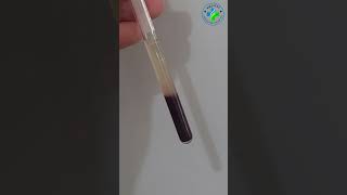 ESR test | Erythrocytes sedimentation rate #medicallaboratory #bloodtest #hematology