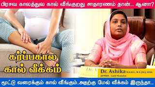 Leg Swelling During Pregnancy in Tamil | கர்ப்பகால கால் வீக்கம் | Leg Edema Treatment | Dr Ashika