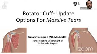 Rotator Cuff- Options for Massive Tears