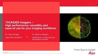 THUNDER Imagers Webinar: High performance, versatility and ease-of-use for your imaging workflows