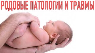 РОДОВЫЕ ПАТОЛОГИИ НОВОРОЖДЕННЫХ | Как предотвратить родовые травмы у младенцев | Осложнения в родах