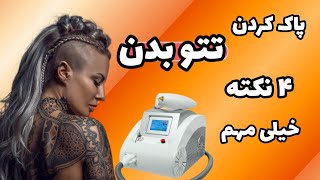 تتو صورت و بدن و ۴ نکته مهم برای تعداد جلسات تتو با لیزر کیوسوییچ خرم آباد شاپ