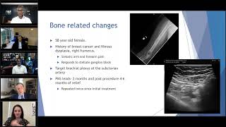 NANS Education Committee Webinar- Neuromodulation for Cancer Patients