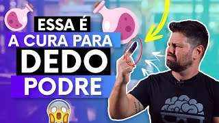 COMO ACABAR COM O DEDO PODRE (Dicas de relacionamento por Alexandre Chollet)