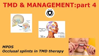 Temperomandibular Disorders & Management-Part 4