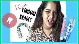 I got my Lingual Braces| Do they Hurt? | How can you own them? | Have a Talk With Me #1