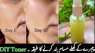 Sprayed Cucumber Toner on your face daily | Closed open pores , Remove dark spots .