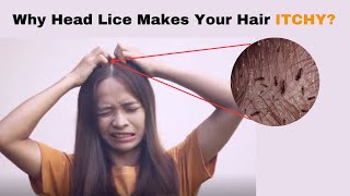 Why Head Lice Makes Your Hair Itchy?