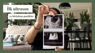 Hamilelikte Toksoplazma  | İlk Ultrason  | Aralıklı Oruç  | Mide Bulantısı??