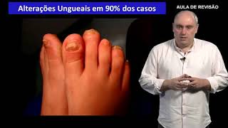 1-4) ESPONDILOARTROPATIAS SORONEGATIVAS E ARTRITE PSORIASICA