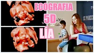 💗ECOGRAFIA 5D💗 // 27 / 28 SEMANAS // MUY EMOTIVA 👶 💖 // Rocío Soriano // JULIO 2018