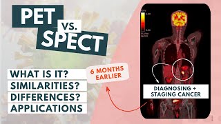 PET vs SPECT | The basics (Updated video)