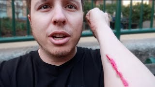 HE HAD AN ACCIDENT!! (OUCH)