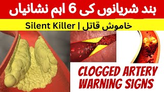 Signs and Symptoms of Clogged Arteries | بند شریانوں کی علامات | Dil ki band sharyano ki alamaat