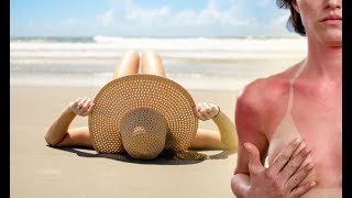 How to get rid of sunburn Three ways to eradicate blisters and peeling skin at home