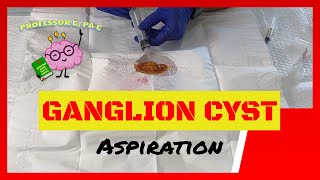 Ganglion Cyst Aspiration on a Homemade Demo