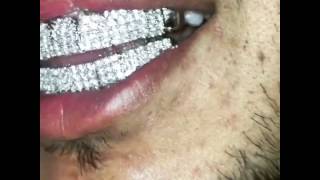 CS_GRILLZ PRONG SET DIAMOND GRILLZ