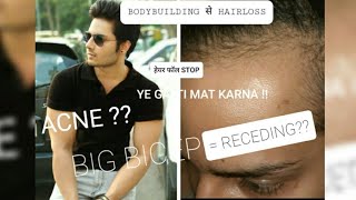 Bodybuilding से  Hairfall|| Stop Receding Hairline|| Stop Pimple, Acne||Minoxidil Finasteride| hindi