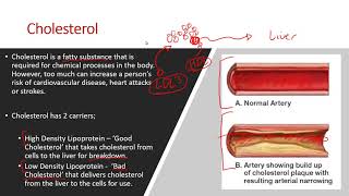 AQA A Level PE (2018) - Cardiovascular System Lesson