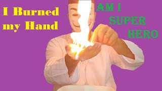 I Burned my Handدستمو سوزوندم