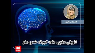 آتروفی مغزی؛ علت کوچک شدن مغز