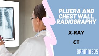 Pleura and chest wall radiography easy learn radiography X-Ray and CT