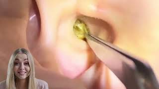 Dr.Natacha ASMR earclining relaxing satisfying video.