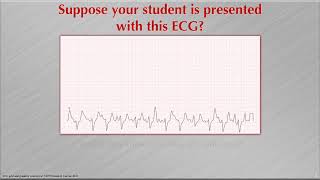 Arrhythmia Recognition: It's Not Just About Recognition Any More!