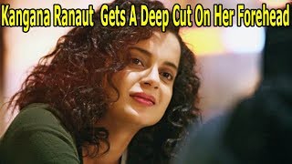 Kangana Ranaut Gets A Deep Cut On Her Forehead | Latest News