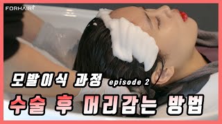 모발이식 후 샴푸방법 어떻게 해야할까? 헤어라인이식 2번째 후기ㅣ포헤어 서울