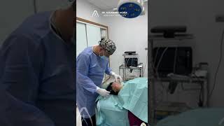 Dr. Alejandro Acuña | endolifting de papada