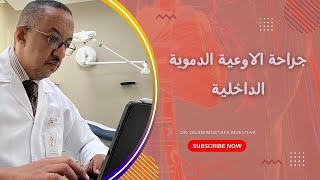 جراحة الاوعية الدموية الداخلية