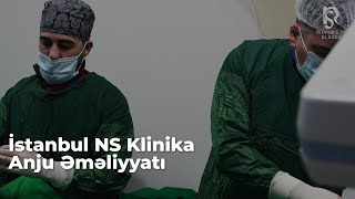 İstanbul NS Klinika - Anju emeliyyati