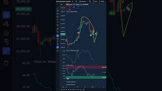 Bitcoin Next Best Entry? We Pumped 21% Last Time! (Watch These Signals)