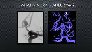 Brain Aneurysms with Dr. Spiros Blackburn