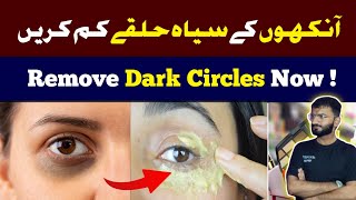 Dark Circles: Say Goodbye to Dark Circles | Home Remedies for Removing Dark Circles