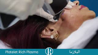 PRP (Platelet Rich Plasma)