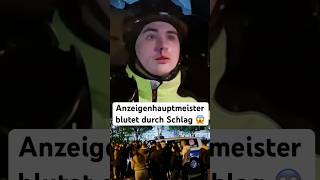 Anzeigenhauptmeister kriegt Faust ins Gesicht 😱❌