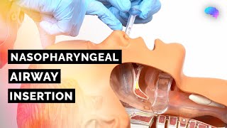 Nasopharyngeal Airway (NPA) Insertion | ABCDE Emergency | OSCE Guide | UKMLA | CPSA | PLAB 2