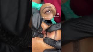 Permanent eyeliner