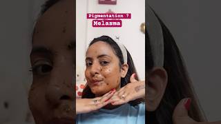 Melasma Treatment , Pigmentation Cure | Apply this homemade mask #pigmentation #youtubeshorts