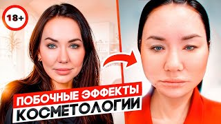 Что случилось со мной после процедуры?Побочные эффекты косметологии.