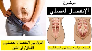 الانفصال العضلي أسبابه وأعراضه وعلاجه وطرق الحماية منه ✨ د.هند عناية