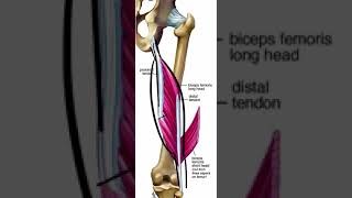 LESIÓN DEL BÍCEPS FEMORAL. CUIDADO CON LA PORCIÓN LARGA.