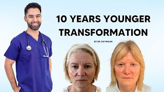 10 Years Younger - Transformation of the Year (2024)