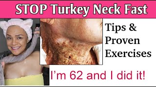 The PROVEN Neck and Jowl Exercise That Everyone Is Talking About